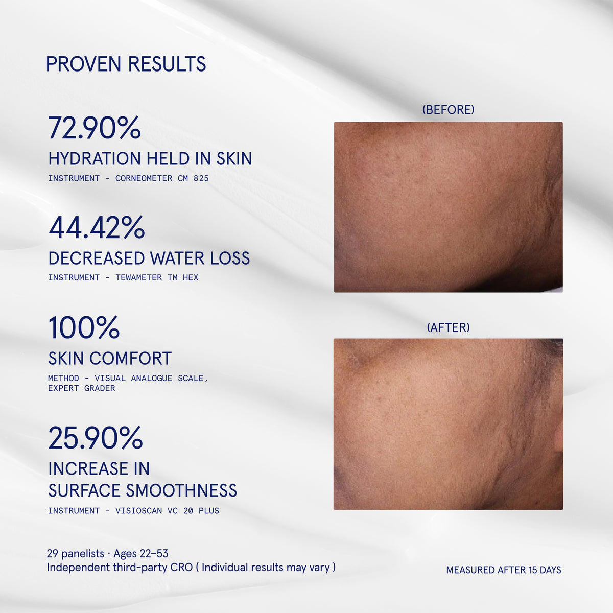SKIN-BARRIER MOISTURIZER