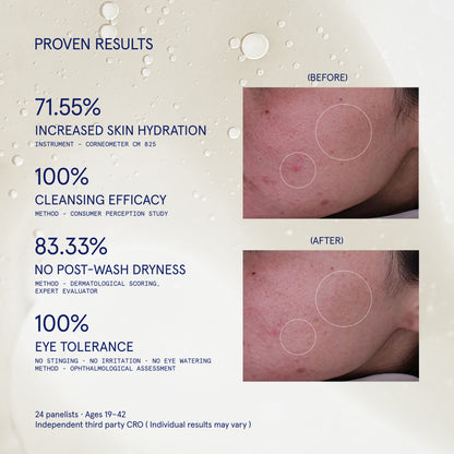 SKIN-RESET CLEANSER